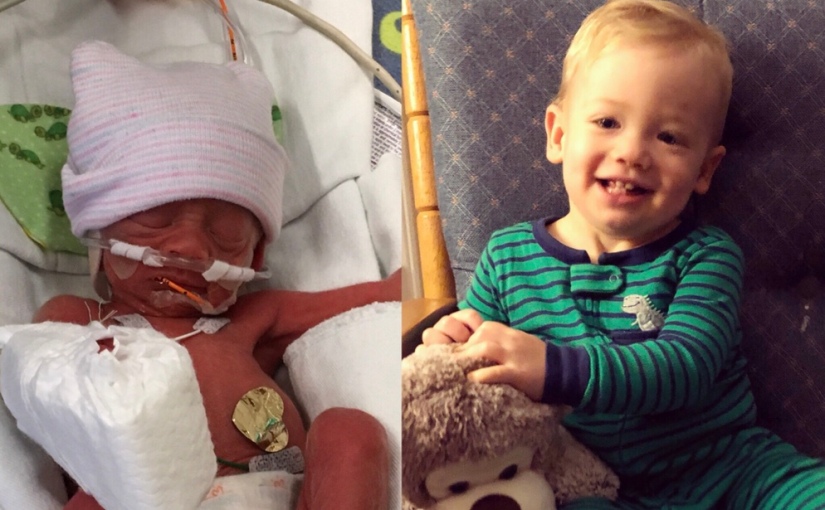 5 Things to Expect as the Parent of a Preemie